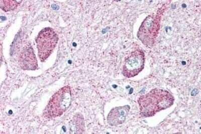 Immunohistochemistry-Paraffin: Wnt-8b Antibody - BSA Free [NBP1-39604] - Analysis of anti-WNT8B antibody with human brain, basal nucleus of meynert at concentration 10 ug/ml.