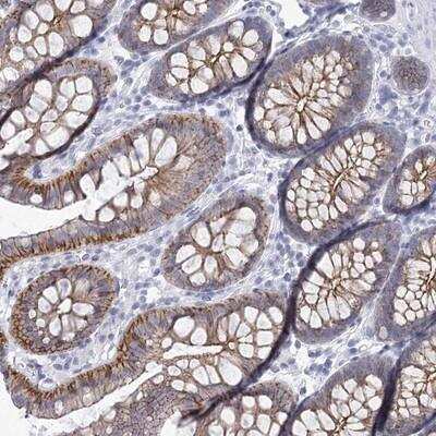 Immunohistochemistry-Paraffin: Wnt-8b Antibody [NBP1-86285] - Staining of human colon shows moderate membranous and cytoplasmic positivity in glandular cells.