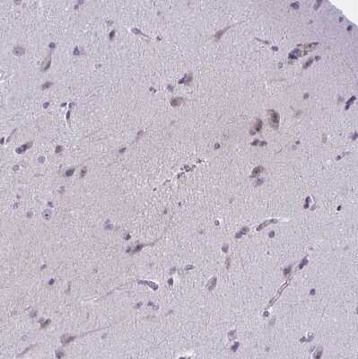 Immunohistochemistry-Paraffin: Wnt-9b Antibody [NBP2-34110] - Staining of human Cerebral cortex shows weak cytoplasmic positivity in neuronal cells.