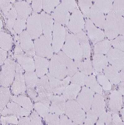 Immunohistochemistry-Paraffin: Wnt-9b Antibody [NBP2-34110] - Staining of human Skeletal muscle shows no positivity in myocytes as expected.