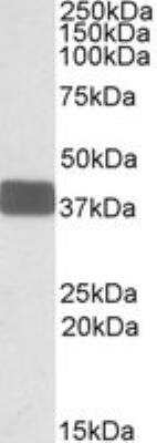 Western Blot: Wnt-9b Antibody [NBP1-51961] -  Human Brain Cerebellum lysate (35ug protein in RIPA buffer) using NBP1-51961 at 0.3ug/ml. Primary incubation was 1 hour. Detected by chemiluminescence.