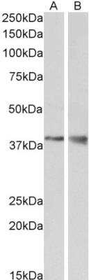 Western Blot: Wnt-9b Antibody [NBP1-51961] - Analysis of Mouse Kidney (A) and Brain (B) lysate (35 ug protein in RIPA buffer). Primary incubation was 1 hour. Detected by chemiluminescence.