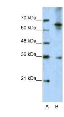 Western Blot: Wnt-9b Antibody [NBP1-57937] - Jurkat cell lysate, Antibody Titration: 5.0ug/ml