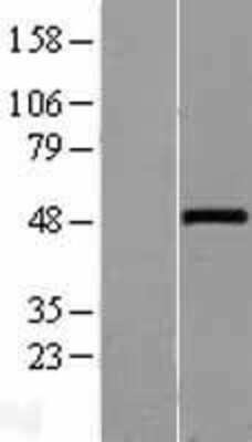 Western Blot: Wnt10a Overexpression Lysate (Adult Normal) [NBL1-17861] Left-Empty vector transfected control cell lysate (HEK293 cell lysate); Right -Over-expression Lysate for Wnt10a.