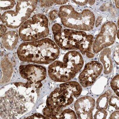 Immunohistochemistry-Paraffin Wnt16 Antibody - BSA Free