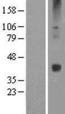 Western Blot Wnt16 Overexpression Lysate