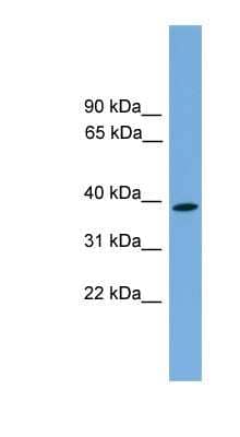 Western Blot: Wnt3 Antibody [NBP1-56996] - Fetal Brain lysate, concentration 0.2-1 ug/ml.