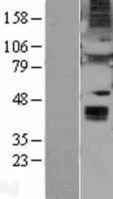 Western Blot: Wnt6 Overexpression Lysate (Adult Normal) [NBL1-17875] Left-Empty vector transfected control cell lysate (HEK293 cell lysate); Right -Over-expression Lysate for Wnt6.