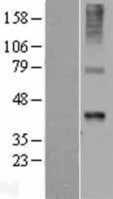 Western Blot: Wnt7b Overexpression Lysate (Adult Normal) [NBL1-17877] Left-Empty vector transfected control cell lysate (HEK293 cell lysate); Right -Over-expression Lysate for Wnt7b.