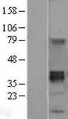 Western Blot Wnt-8b Overexpression Lysate