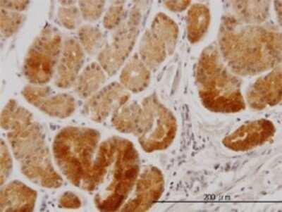 Immunohistochemistry-Paraffin XAB1 Antibody (3E1) - Azide and BSA Free