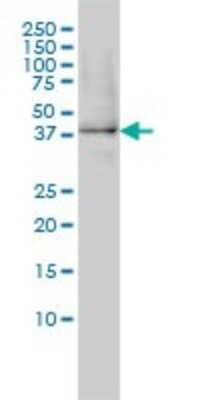 Western Blot: XAB1 Antibody (3E1) [H00011321-M01] - XAB1 monoclonal antibody (M01), clone 3E1 Analysis of XAB1 expression in HL-60.