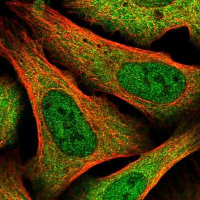 <b>Independent Antibodies Validation. </b>Immunocytochemistry/Immunofluorescence: XAB1 Antibody [NBP2-38332] - Immunofluorescent staining of human cell line U-2 OS shows localization to nucleoplasm & cytosol.