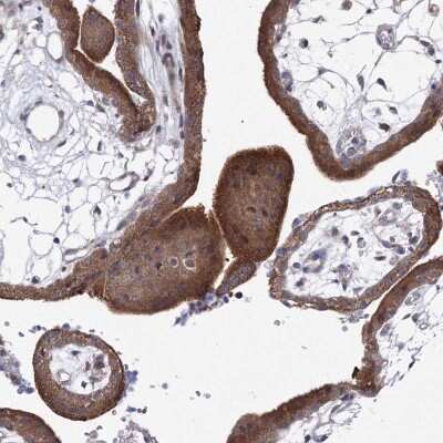Immunohistochemistry: XAB1 Antibody [NBP2-38332] - Staining of human placenta shows strong cytoplasmic positivity in trophoblastic cells.