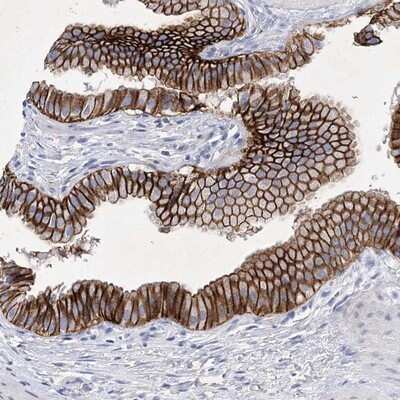 Immunohistochemistry-Paraffin: XAB1 Antibody [NBP1-90072] - Staining of human gall bladder shows strong cytoplasmic and membranous positivity in glandular cells.