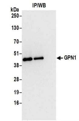 <b>Biological Strategies Validation. </b>Immunoprecipitation: XAB1 Antibody [NBP2-37686] - Whole cell lysate (0.5 or 1.0 mg per IP reaction; 20% of IP loaded) from 293T cells prepared using NETN lysis buffer.  Affinity purified rabbit anti-GPN1 antibody used for IP at 6 ug per reaction.  GPN1 was also immunoprecipitated by rabbit anti-GPN1 antibody.  For blotting immunoprecipitated GPN1, was used at 0.4 ug/ml.  Detection: Chemiluminescence with an exposure time of 10 seconds.