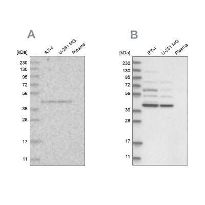 <b>Independent Antibodies Validation. </b>Western Blot: XAB1 Antibody [NBP1-90072] - Analysis using Anti-GPN1 antibody NBP1-90072 (A) shows similar pattern to independent antibody NBP2-38332 (B).