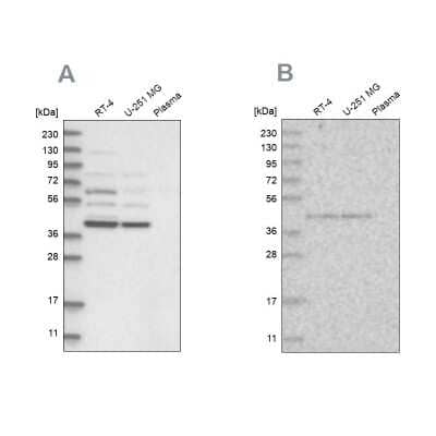 Western Blot: XAB1 Antibody [NBP2-38332] - Analysis using Anti-GPN1 antibody NBP2-38332 (A) shows similar pattern to independent antibody NBP1-90072 (B).