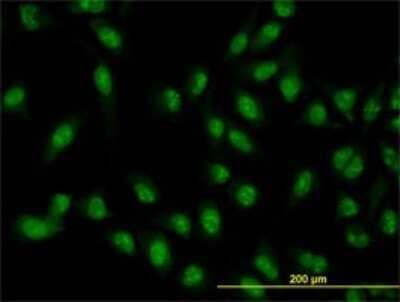 Immunocytochemistry/ Immunofluorescence XAB2 Antibody (1D1-1A9)