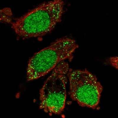Immunocytochemistry/Immunofluorescence: XAB2 Antibody [NBP2-58367] - Staining of human cell line PC-3 shows localization to nucleoplasm, nucleoli & vesicles.