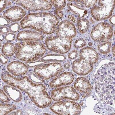 Immunohistochemistry-Paraffin: XAF1 Antibody [NBP2-49253] - Staining of human kidney shows strong cytoplasmic positivity in cells in tubules.