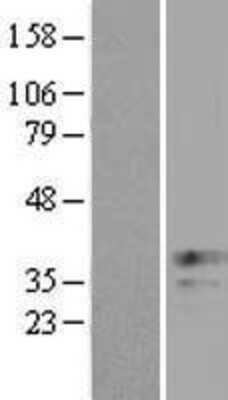 Western Blot: XAF1 Overexpression Lysate (Adult Normal) [NBL1-17897] Left-Empty vector transfected control cell lysate (HEK293 cell lysate); Right -Over-expression Lysate for XAF1.