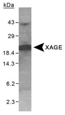 Western Blot XAGE1 Antibody