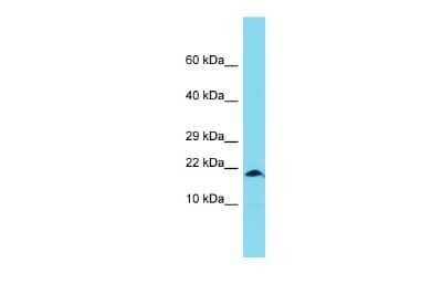 Western Blot XAGE1A Antibody