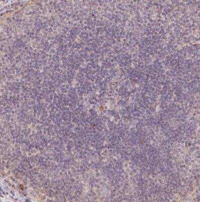 Immunohistochemistry-Paraffin XAGE2 Antibody - BSA Free