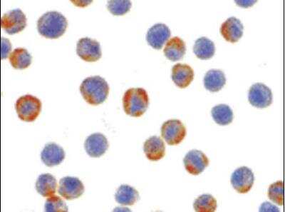 Immunocytochemistry/Immunofluorescence: XBP1 Antibody [NB100-80861] - XBP-1 in HepG2 cells with XBP-1 antibody at 2 ug/ml.
