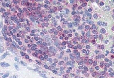 Immunohistochemistry-Paraffin: XCR1/CCXCR1 Antibody - BSA Free [NBP1-02343] - Human spleen tissue after heat-induced antigen retrieval.