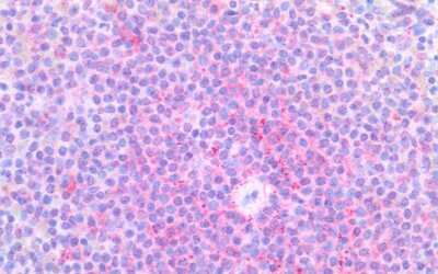 Immunohistochemistry-Paraffin: XCR1/CCXCR1 Antibody - BSA Free [NBP1-02345] - Human Spleen