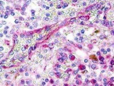 Immunohistochemistry-Paraffin: XCR1/CCXCR1 Antibody [NLS156] - Analysis of anti-XCR1 antibody with human spleen at 2.5 ug/ml.