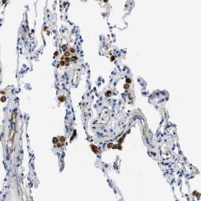 Immunohistochemistry-Paraffin: XCR1/CCXCR1 Antibody [NBP1-88143] - Staining of human lung shows strong positivity in macrophages.