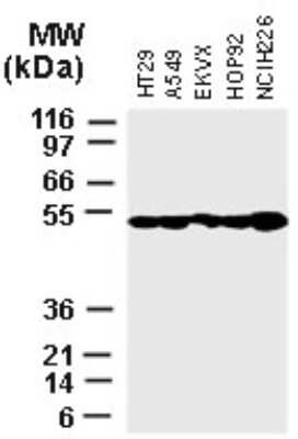 Western Blot: XIAP Antibody - Unpurified [NB100-56184] - Analysis of XIAP in various tumor cell lines using this antibody at 1:2000.