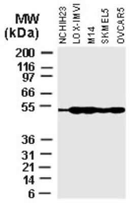 Western Blot: XIAP Antibody [NB100-56185] - Analysis of XIAP in various Tumor Cell lines using this antibody at 1:2000.