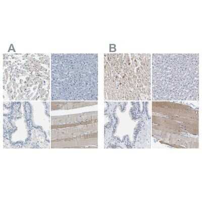 <b>Independent Antibodies Validation and Orthogonal Strategies Validation.</b>Immunohistochemistry-Paraffin: XIRP1 Antibody [NBP1-85529] - Staining of human heart muscle, liver, prostate and skeletal muscle using Anti-XIRP1 antibody NBP1-85529 (A) shows similar protein distribution across tissues to independent antibody NBP1-85530 (B).