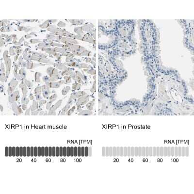Immunohistochemistry-Paraffin: XIRP1 Antibody [NBP1-85529] - Analysis in human heart muscle and prostate tissues using NBP1-85529 antibody. Corresponding XIRP1 RNA-seq data are presented for the same tissues.