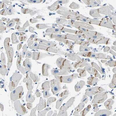 Immunohistochemistry-Paraffin: XIRP1 Antibody [NBP1-85529] - Staining of human heart muscle shows moderate positivity in intercalated discs.