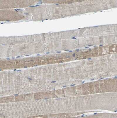 Immunohistochemistry-Paraffin: XIRP1 Antibody [NBP1-85529] - Staining of human skeletal muscle shows weak to moderate cytoplasmic positivity in myocytes.