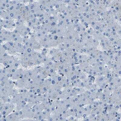 Immunohistochemistry-Paraffin: XIRP1 Antibody [NBP1-85529] - Staining of human liver shows no positivity in hepatocytes as expected.