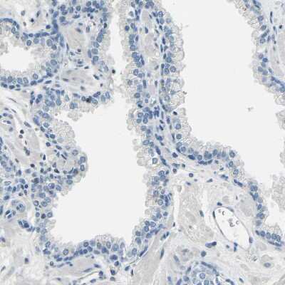 Immunohistochemistry-Paraffin: XIRP1 Antibody [NBP1-85529] - Staining of human prostate shows no positivity in glandular cells as expected.