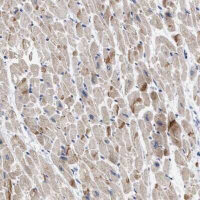 Immunohistochemistry-Paraffin: XIRP1 Antibody [NBP1-85530] - Staining of human heart muscle shows high expression.