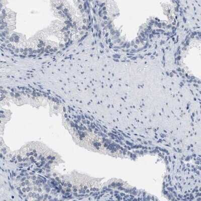 Immunohistochemistry-Paraffin: XIRP1 Antibody [NBP1-85530] - Staining of human prostate shows low expression as expected.
