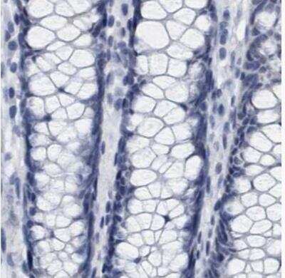 Immunohistochemistry-Paraffin: XIRP1 Antibody [NBP1-85530] - Staining of human colon using Anti-XIRP1 antibody.