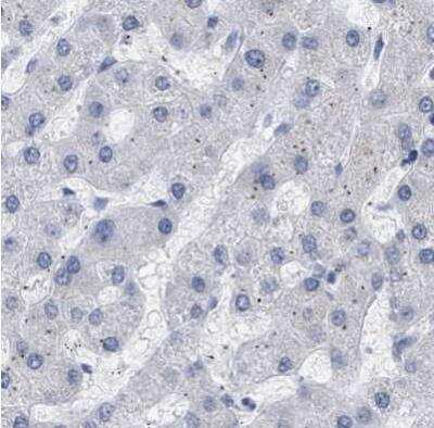 Immunohistochemistry-Paraffin: XIRP1 Antibody [NBP1-85530] - Staining of human liver using Anti-XIRP1 antibody.