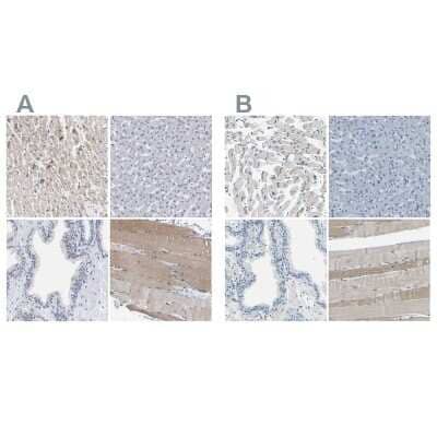 <b>Independent Antibodies Validation. </b>Immunohistochemistry-Paraffin: XIRP1 Antibody [NBP1-85530] - Staining of human heart muscle, liver, prostate and skeletal muscle using Anti-XIRP1 antibody NBP1-85530 (A) shows similar protein distribution across tissues to independent antibody NBP1-85529 (B).