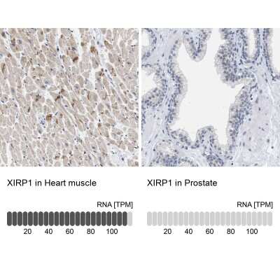 <b>Orthogonal Strategies Validation. </b>Immunohistochemistry-Paraffin: XIRP1 Antibody [NBP1-85530] - Analysis in human heart muscle and prostate tissues using NBP1-85530 antibody. Corresponding XIRP1 RNA-seq data are presented for the same tissues.