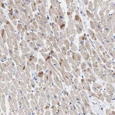 Immunohistochemistry-Paraffin: XIRP1 Antibody [NBP1-85530] - Staining of human heart muscle shows moderate positivity in intercalated discs.