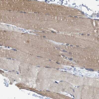 Immunohistochemistry-Paraffin: XIRP1 Antibody [NBP1-85530] - Staining of human skeletal muscle shows moderate cytoplasmic positivity in myocytes.